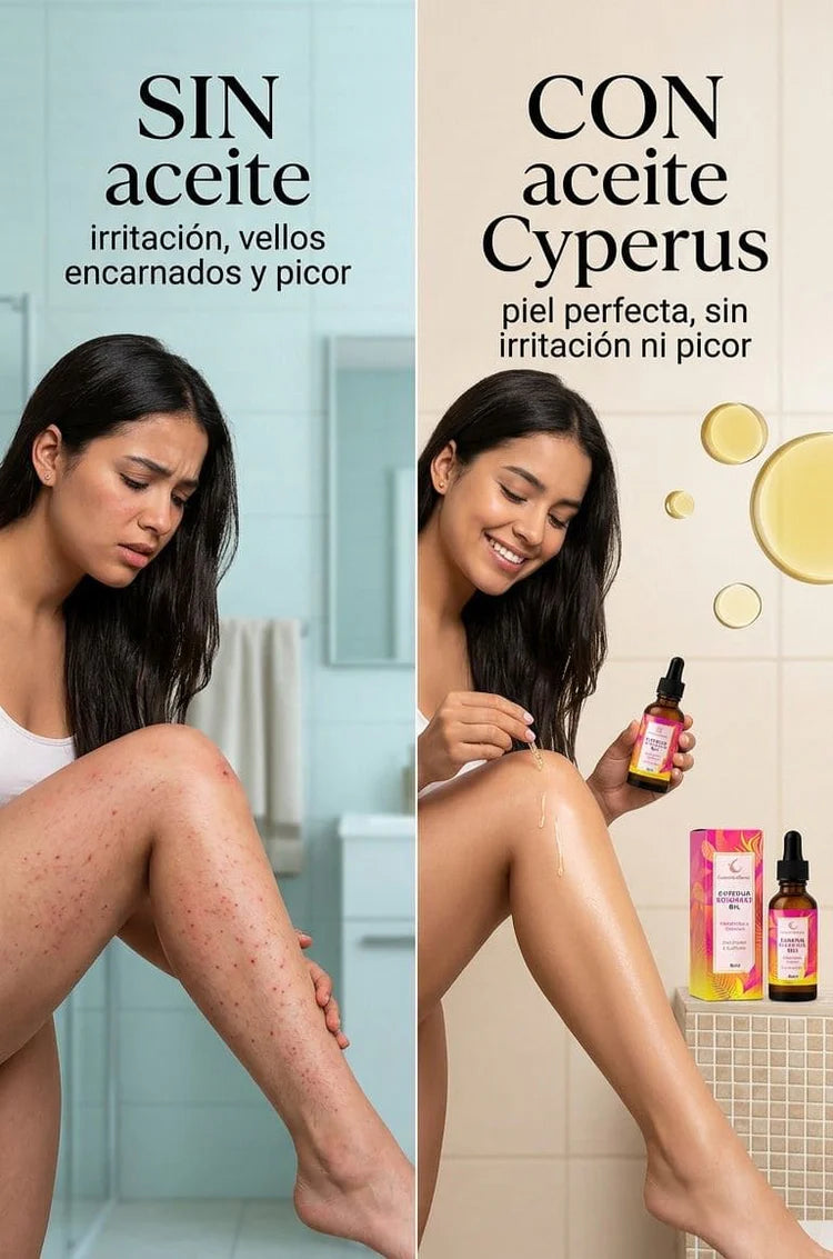 CYPERUS OIL - EL FIN DE LA DEPILACIÓN